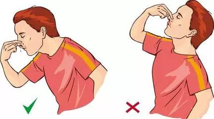 小孩子流鼻血怎么止住 孩子流鼻血處理方法 小孩子流鼻血怎么止住 孩子流鼻血處理方法