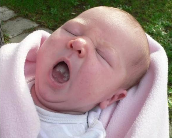 寶寶嘴里的白色東西是鵝口瘡嗎 怎么區分鵝口瘡和奶垢