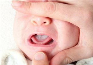 寶寶嘴里的白色東西是鵝口瘡嗎 怎么區(qū)分鵝口瘡和奶垢