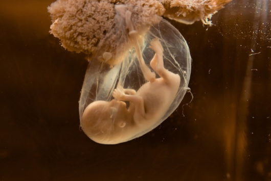 孕期為何要檢查羊水  孕期羊水問題匯總