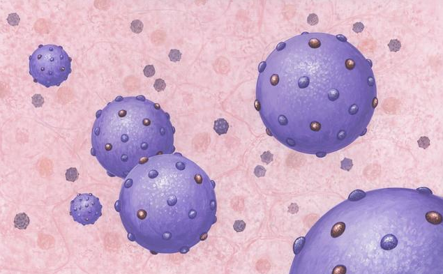 假性濕疣是什么 怎么區分假性濕疣和尖銳濕疣