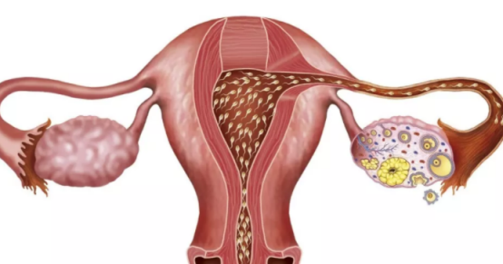 宮外孕沒有癥狀是怎么回事 宮外孕怎么發現 宮外孕沒有癥狀是怎么回事 宮外孕怎么發現