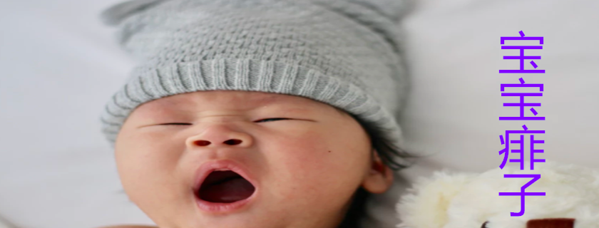 寶寶換尿布后為什么不能用痱子粉 寶寶尿布疹怎么辦
