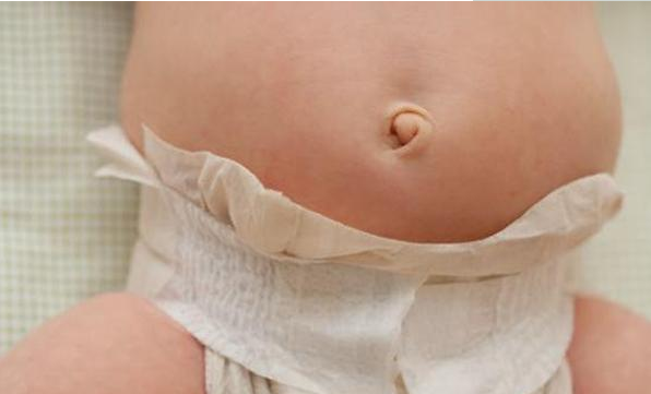 寶寶肚子鼓鼓的就是脹氣了嗎 寶寶脹氣處理方法 寶寶肚子鼓鼓的就是脹氣了嗎 寶寶脹氣處理方法