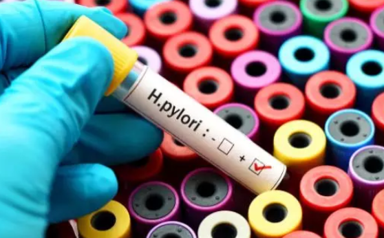 小孩幽門螺旋桿菌弱陽性怎么辦 幽門螺桿菌呈弱陽性怎么治療