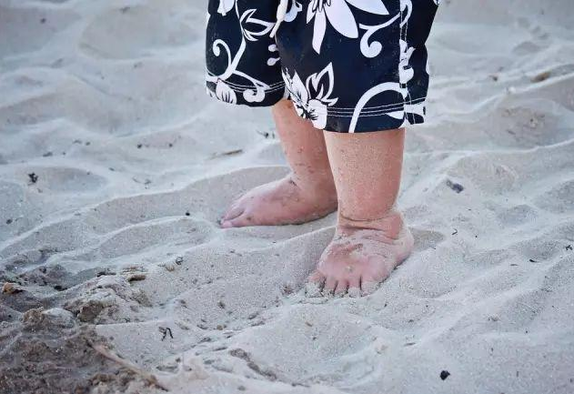 1歲寶寶喜歡踮起腳尖走路正常嗎 寶寶踮腳走路糾正方法