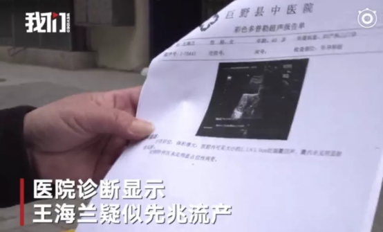 孕婦打過期保胎針流產 打過期保胎針醫院被罰款5萬