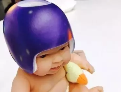寶寶矯正頭盔需要帶多久 寶寶經常帶矯正頭盔累不累 寶寶矯正頭盔需要帶多久 寶寶經常帶矯正頭盔累不累
