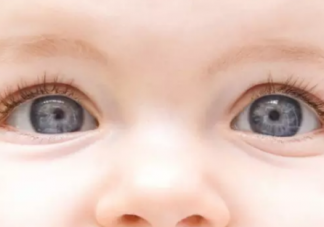 雙眼皮父母會生出單眼皮孩子嗎 單眼皮孩子概率大嗎