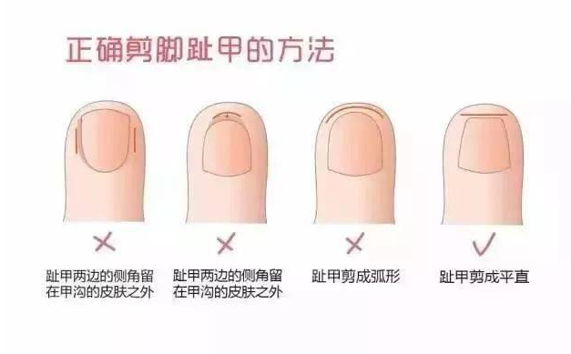 寶寶多久剪一次指甲 寶寶指甲該怎么剪 寶寶多久剪一次指甲 寶寶指甲該怎么剪