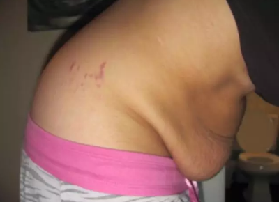 剛生完孩子肚子還是很大是怎么回事 生完孩子肚子多久可以恢復