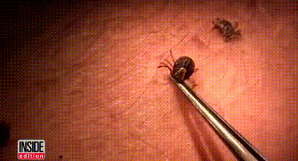 黑腿蜱蟲有什么危害 被蜱蟲咬了怎么處理 黑腿蜱蟲有什么危害 被蜱蟲咬了怎么處理