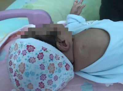 孕檢報告正常出生卻沒右臂 孩子沒有右臂是什么情況