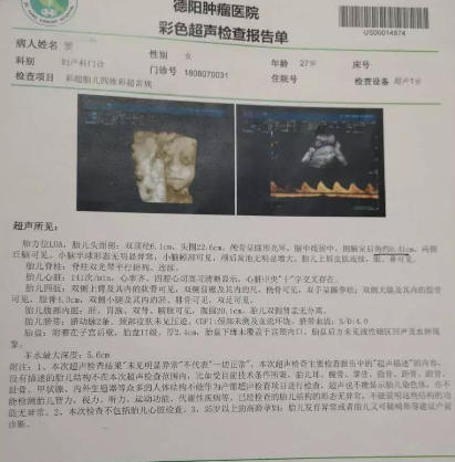 孕檢報告正常出生卻沒右臂 孩子沒有右臂是什么情況