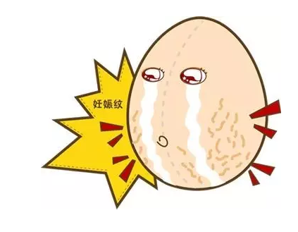 為什么女性懷孕會出現妊娠紋 妊娠紋怎怎么去除