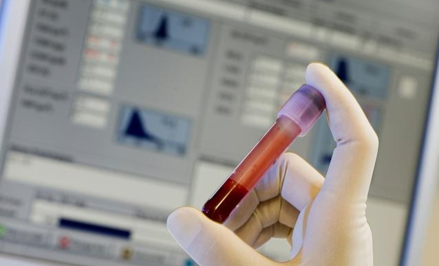 臍帶血有必要存嗎 哪些人更需要存臍帶血 臍帶血有必要存嗎 哪些人更需要存臍帶血