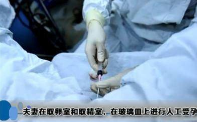 做試管嬰兒疼不疼 做試管嬰兒去哪里好 做試管嬰兒疼不疼 做試管嬰兒去哪里好