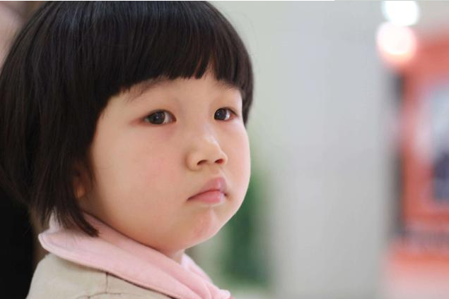 小孩什么時候容易有疝氣 小孩有疝氣需要去醫院嗎