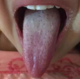 寶寶上火有哪些癥狀 怎么區(qū)分實火和虛火 寶寶上火有哪些癥狀 怎么區(qū)分實火和虛火