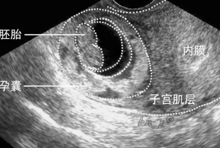 2019年5月1日懷孕生男生女 農(nóng)歷三月二十七懷孕是男孩還是女孩