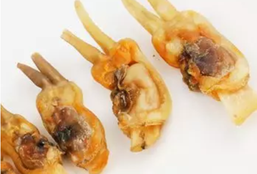 孕婦能吃蟶子嗎 孕婦吃蟶子對胎兒好嗎 孕婦能吃蟶子嗎 孕婦吃蟶子對胎兒好嗎