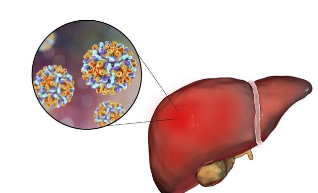 乙肝患者為什么要定期做B超 從乙肝發(fā)展從肝癌要多久時(shí)間
