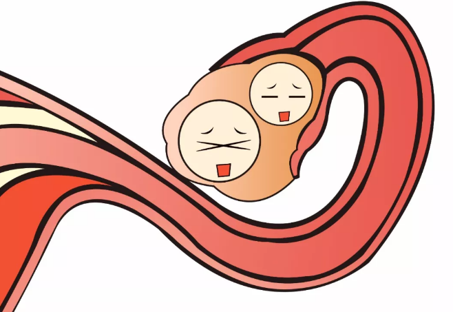 輸卵管造影貴不貴 輸卵管造影醫(yī)院重要還是費(fèi)用重要