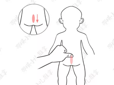 小兒疳證怎么給孩子推拿恢復 如何調理小兒疳證的孩子