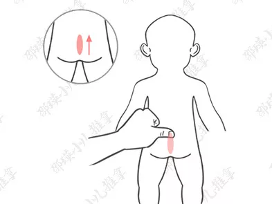小兒疳證怎么給孩子推拿恢復 如何調理小兒疳證的孩子