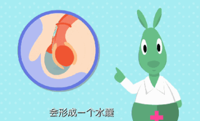 寶寶蛋蛋有積液怎么辦 蛋蛋有積液治療方法