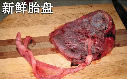 胎盤真的能吃嗎 胎盤真的是大補藥嗎 胎盤真的能吃嗎 胎盤真的是大補藥嗎