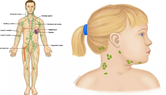 小孩淋巴結腫大怎么辦 小孩淋巴結腫大危險嗎