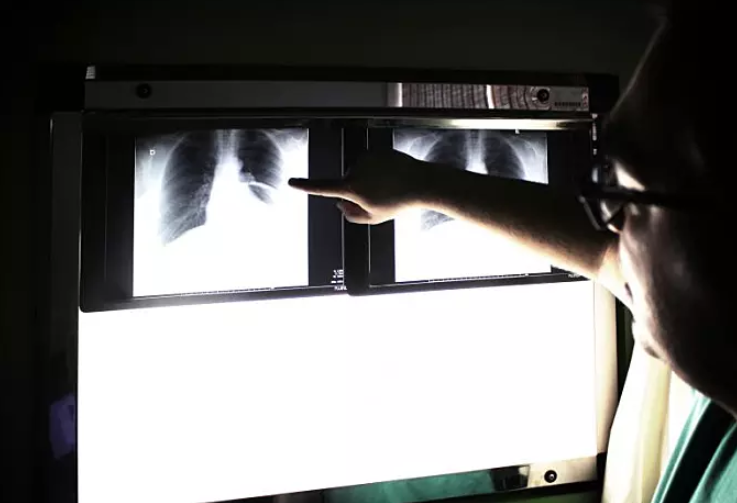 妊娠期哮喘不治療有什么危害 孕期哮喘發作怎么辦 妊娠期哮喘不治療有什么危害 孕期哮喘發作怎么辦