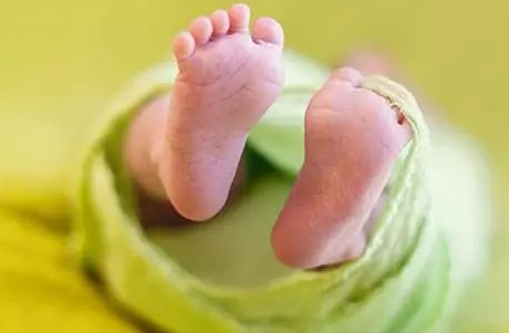 寶寶出生就有黃疸是怎么回事 新生兒黃疸該怎么辦