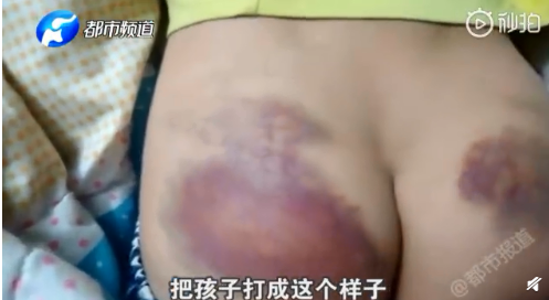 懷孕教師毆打女童是怎么回事 懷孕教師為什么毆打11歲女童