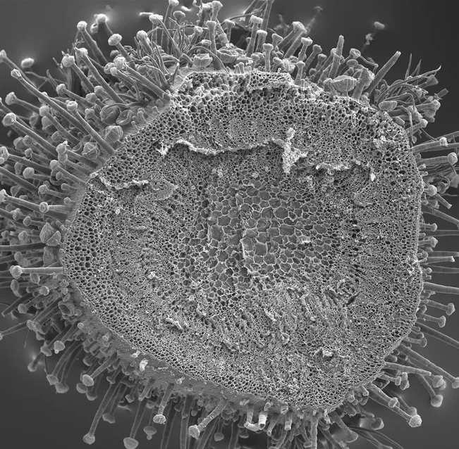 促排卵卵泡是空的是怎么回事 空卵泡和正常卵泡有什么區別 促排卵卵泡是空的是怎么回事 空卵泡和正常卵泡有什么區別