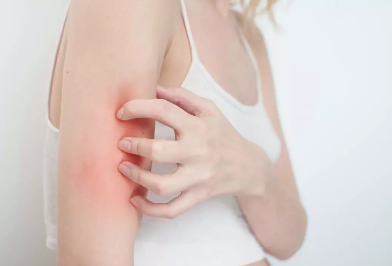 孕期皮膚癢是什么原因 孕期皮膚癢該怎么辦 孕期皮膚癢是什么原因 孕期皮膚癢該怎么辦