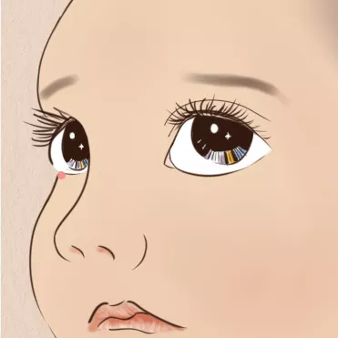 孩子夏天反復長麥粒腫是怎么回事 怎么預防孩子反復長麥粒腫 孩子夏天反復長麥粒腫是怎么回事 怎么預防孩子反復長麥粒腫