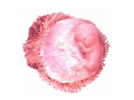 流產(chǎn)后再懷孕幾率大嗎 流產(chǎn)后再懷孕要注意什么 流產(chǎn)后再懷孕幾率大嗎 流產(chǎn)后再懷孕要注意什么