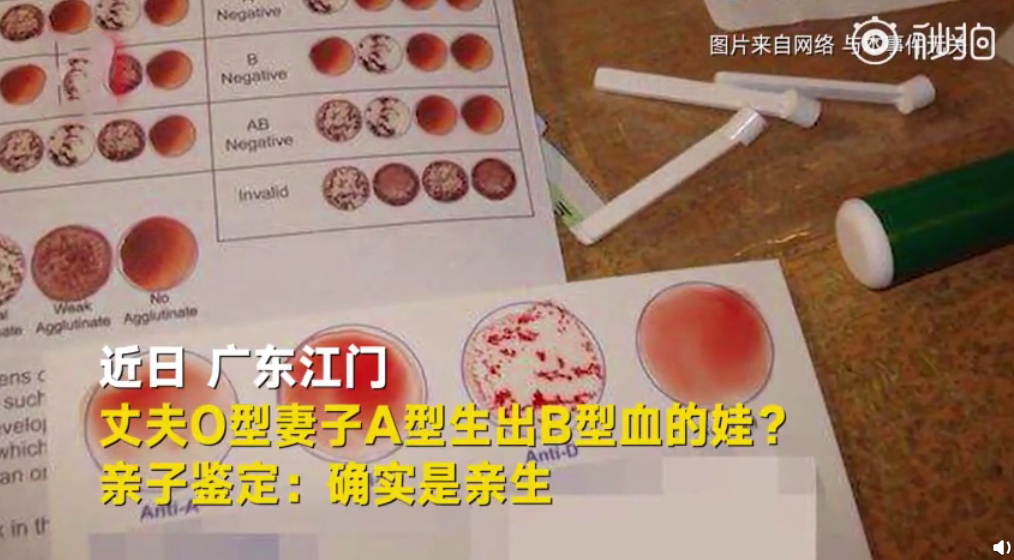 丈夫O型妻子A型生出B型血的娃是親生的嗎 血型O和A生出B血型是怎么回事