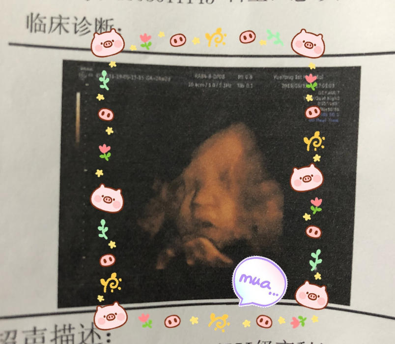 懷孕幸福說(shuō)說(shuō)心情短語(yǔ) 懷孕后感覺幸福說(shuō)說(shuō)朋友圈 懷孕幸福說(shuō)說(shuō)心情短語(yǔ) 懷孕后感覺幸福說(shuō)說(shuō)朋友圈