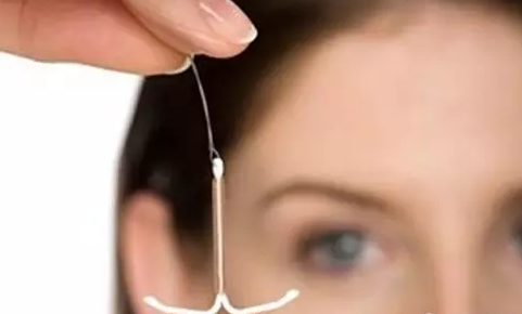 上曼月樂環會長了囊腫嗎 子宮長囊腫和曼月樂環有關嗎 上曼月樂環會長了囊腫嗎 子宮長囊腫和曼月樂環有關嗎