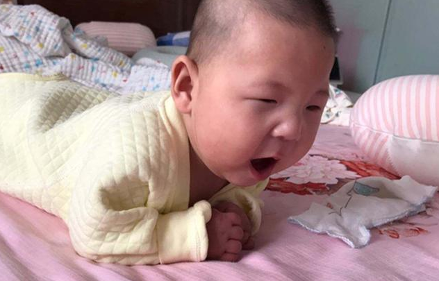 怎么判斷肌張力過高 寶寶肌張力高就是腦癱嗎