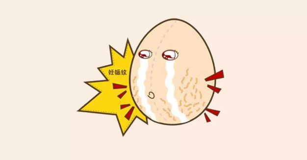 生孩子怎么預防長出妊娠紋 生孩子長妊娠紋消得了嗎