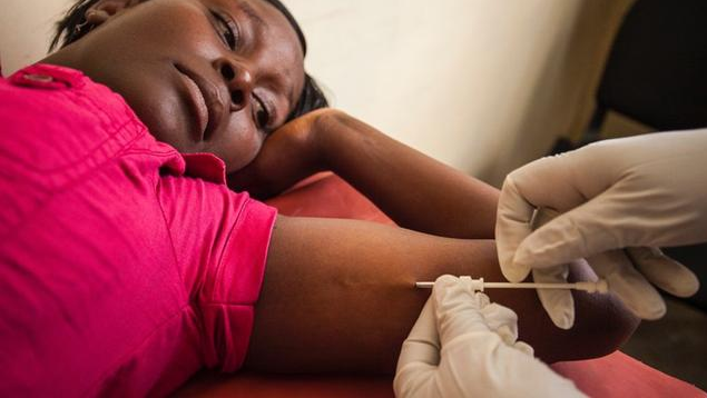 皮下埋值避孕手術什么時候做合適 皮埋避孕法的副作用