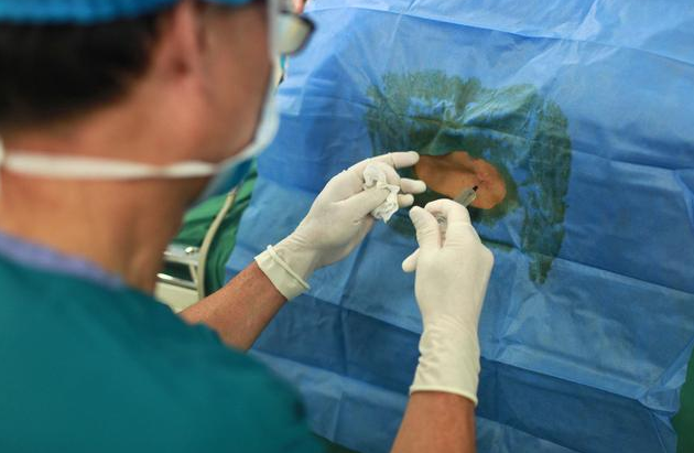 剖腹產打麻藥打哪里 剖腹產打麻藥有什么感覺