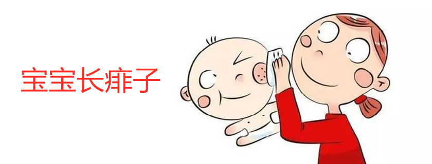 寶寶長痱子為什么不能用痱子粉 寶寶長痱子了該怎么辦