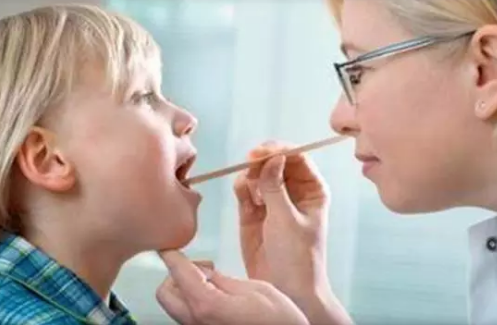 寶寶為什么會患得扁桃體炎 寶寶扁桃體發炎怎么應對