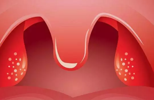 寶寶為什么會患得扁桃體炎 寶寶扁桃體發炎怎么應對