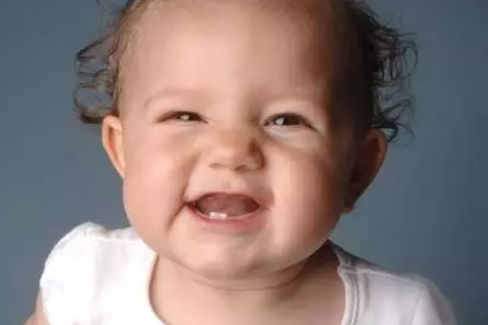 出牙晚是缺鈣嗎 孩子出牙晚是什么情況 出牙晚是缺鈣嗎 孩子出牙晚是什么情況